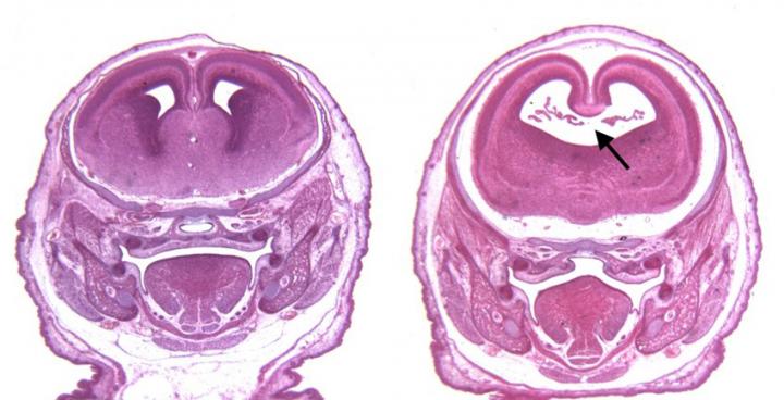Nutritional Memory Counters Affects of Diet Restriction in Older Mice